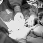 C-section birth photo